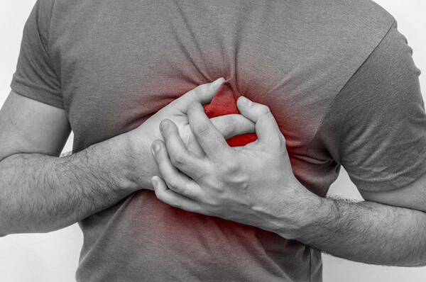 What to Do If Someone Has a Heart Attack
